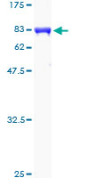 12.5% SDS-PAGE Stained with Coomassie Blue.